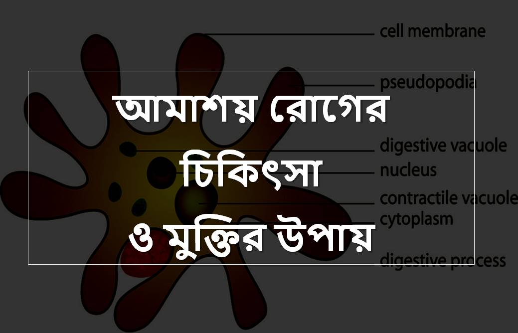 আমাশয়-রোগের-চিকিৎসা-ও-মুক্তির-উপায় Dysentery: Causes, Symptoms, Diagnosis, Treatment
